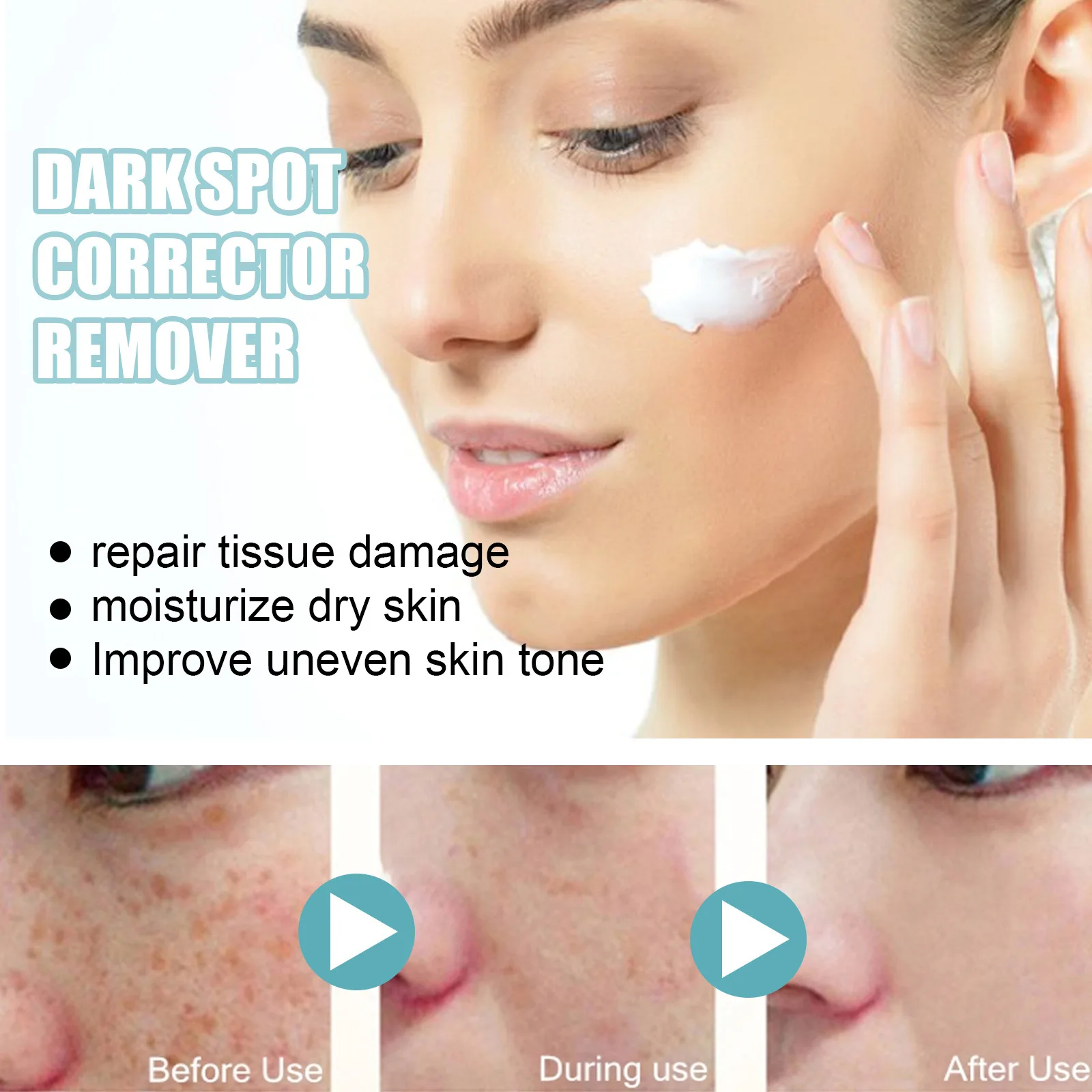 Dark Spot Corrector Cream Nicotinamide Moisturising Brightening_voghion.com