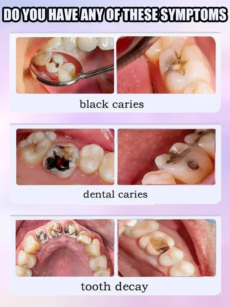 Dental paste Prevent Tooth Decay Dental Caries Whitening Teeth Fresh Breath Repair Tooth Decay Teeth Whitening Product Teeth Whitening Essence Teeth Health Product