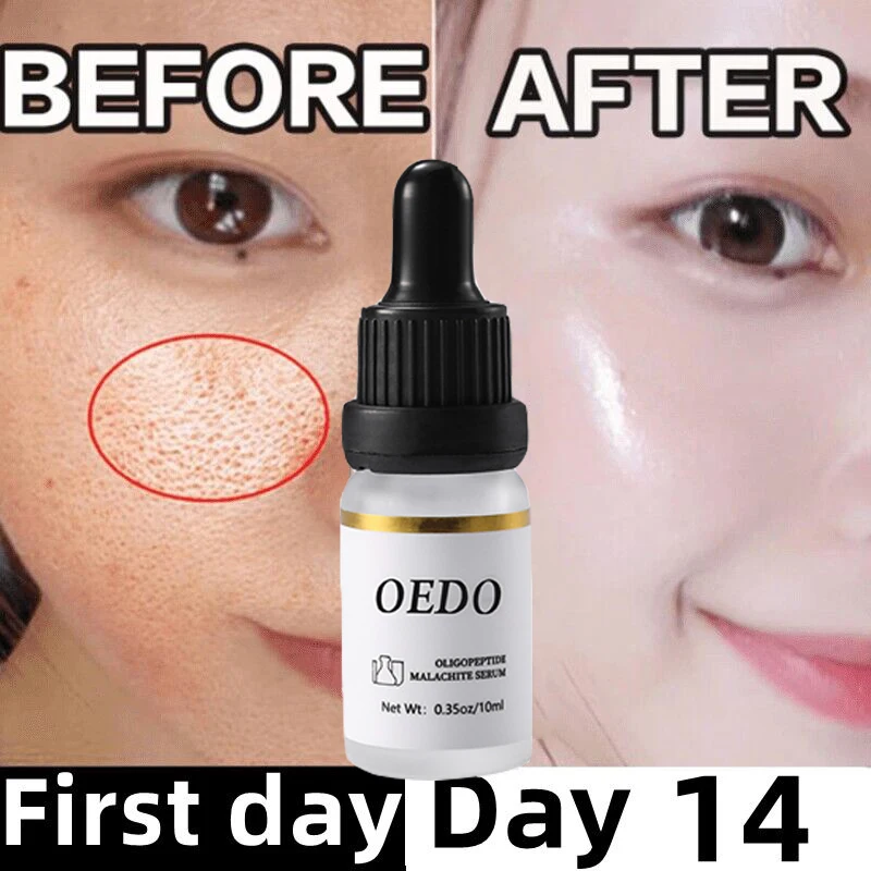 

Pore Shrink Face Serum Pores Minimize Repair Essence Oil Control Blackhead Removal Moisturizing Anti Aging Firm Smooth Skin Care