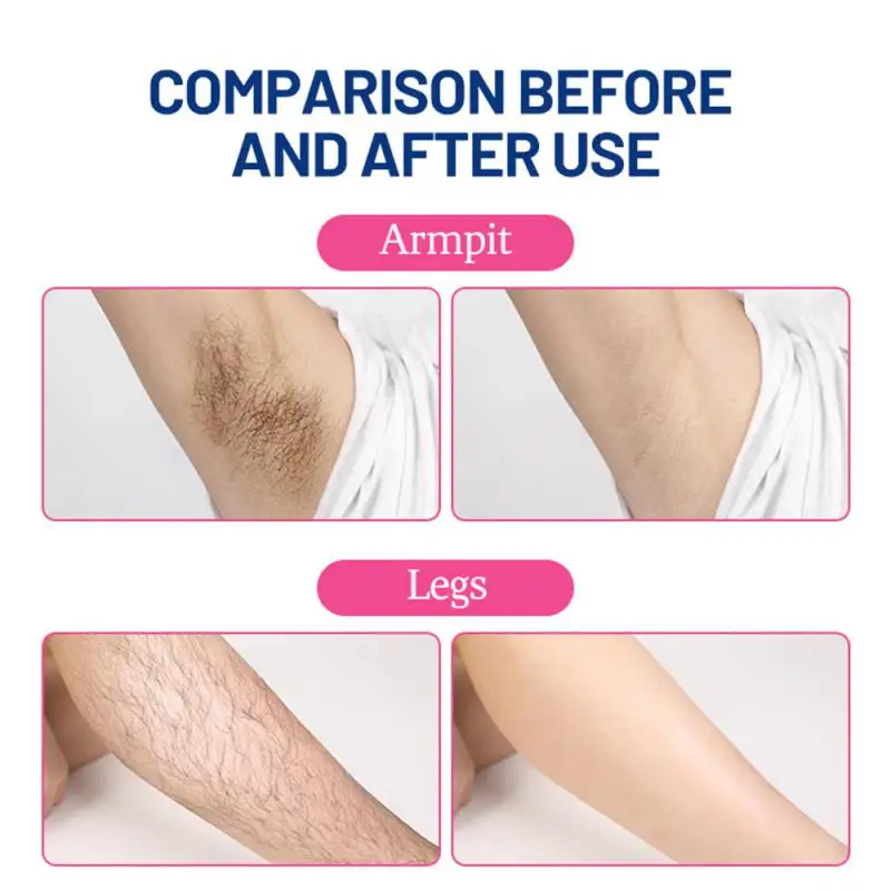 1/20pcs Wax Strips Hair Removal Wax Paper Professional Body Facial Summer Hair Removal Women's Non-permanent Effective Waxing 6
