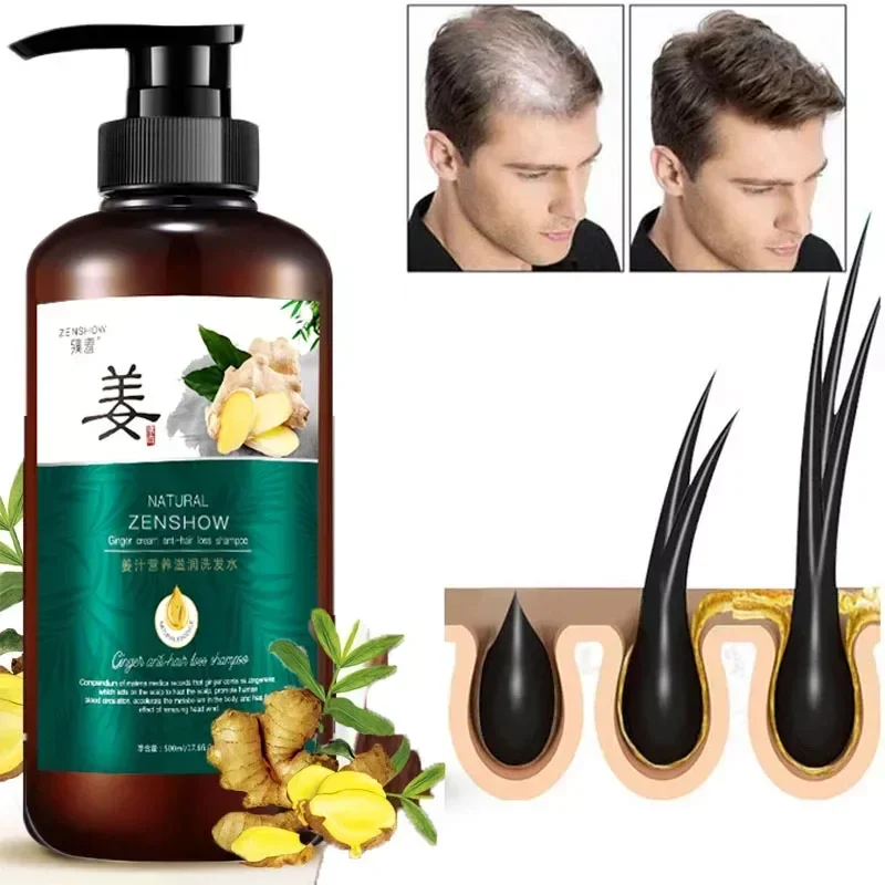 Hair Care Ginger Shampoo Fast Growing Prevent Baldness Repair Scalp Frizzy Damaged Hair Growth Products Natural Anti Hair Loss