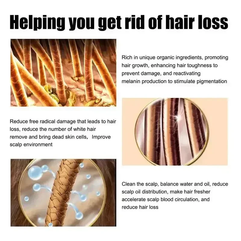 Baldness Hair Loss Care Solution Postpartum Hereditary Follicles