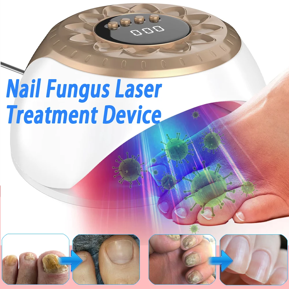 Nail Fungus Laser Treatment Device Repair Toenail Fingernail Fungus Treat Onychomycosis Laser Nails With Mushrooms Remove nail fungus remover laser therapy pen