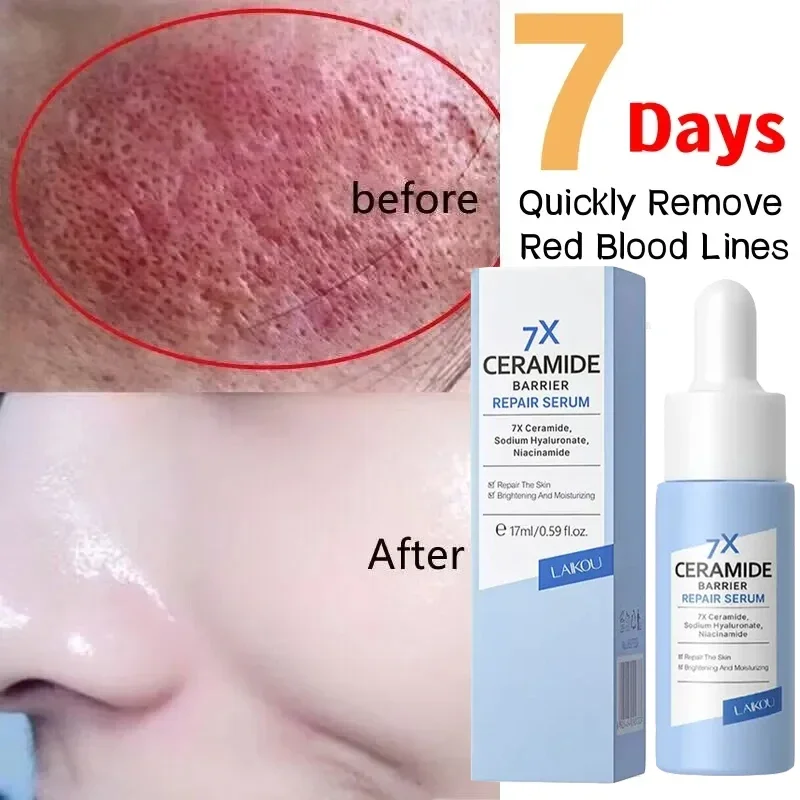 

Repair Facial Redness Serum Soothing Soluation Sensitive Skin Improve Rosacea Shrink Pore Moisturizing Anti Aging Brighten Care