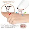Newest Technology Blackhead Remover Vacuum Pore Cleaner for Face&Nose Blackhead Removal Kit Electric Acne Facial Extractor Tool 6