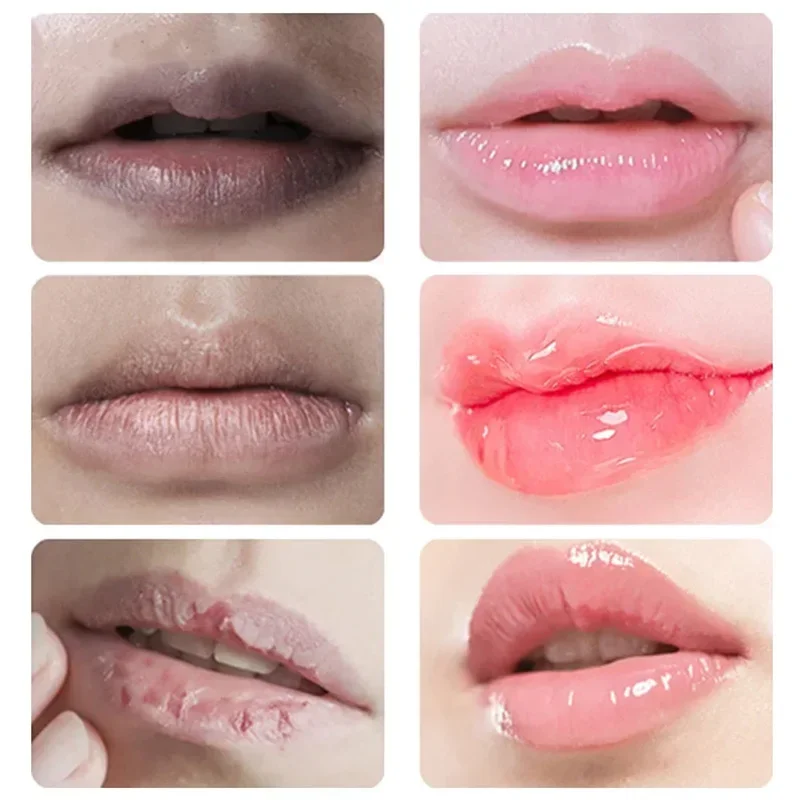 Lips Darkness Removal Lip Balm Lightening Melanin Mask Lipgloss Oil Exfoliating Clean Moisturizer Makeup Beauty Beauty Health 2