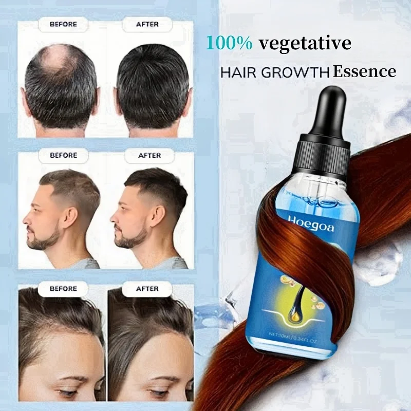 HOEGOA blue bottle.hair growth essential 0iI. Say goodbye to baIdness. The secret 0f thick hair hair growth serums