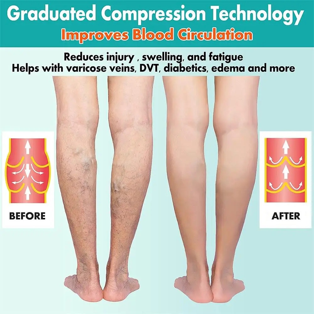 Compression Socks 1Pair S-7XL Marathon Running Sports Socks Men Women 30Mmhg Knee High for Edema Diabetes Varicose Veins