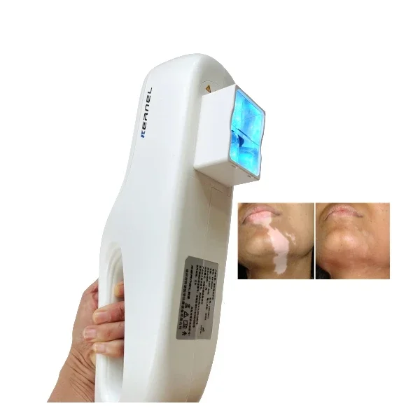

Kernel KN-5000E mini 308 nm excimer UV phototherapy machine for vitiligo psoriasis treatment