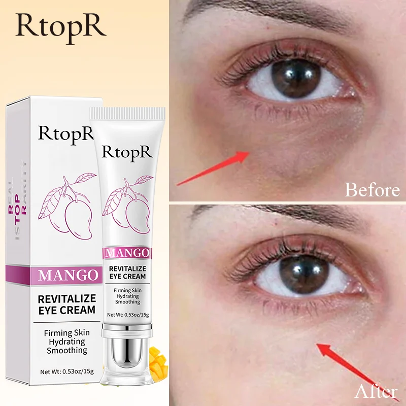 

2pcs Mango Eye Cream Whitening Moisturizing Wrinkle Removal Remove Dark Circles Smooth Fine Lines Firm Eyes Skin Deep Anti-aging
