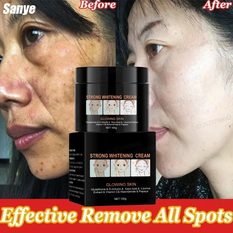 

Vitamin C Freckles For Face Cream Pigments Dark Spots Removal Emulsion Fast Whitening Facial Cream Lightening Skin Care Products