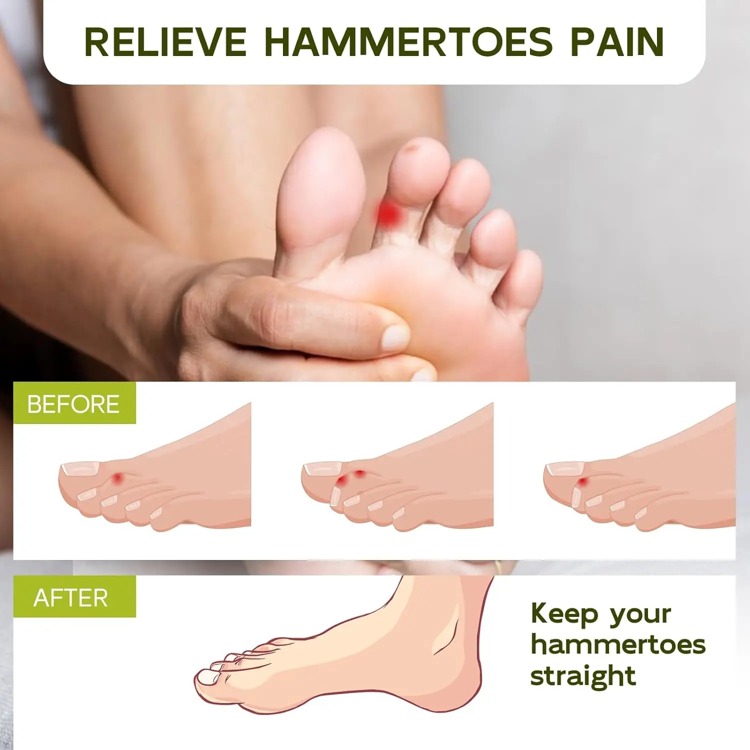 1/2/5/10개입 망치발가락 교정기 부러진 발가락 보호대 망치발가락 교정기 편평발 교정기 발가락 교정기 발 관리용