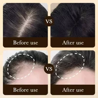 Huile de croissance rapide des cheveux à la biotine, produits de soin, traitements de massage du cuir chevelu, anti-chute de cheveux, sérum efficace pour faire pousser des cheveux plus épais pour hommes 2