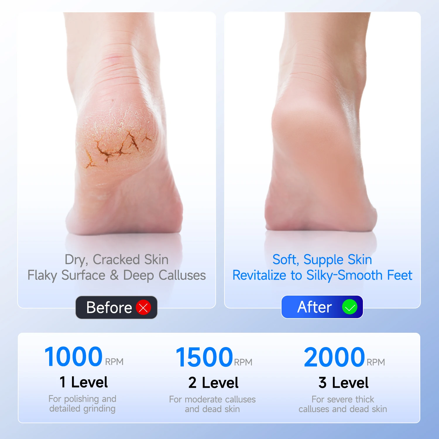 Luluskin - Levigatrice elettrica portatile ricaricabile per piedi, rimozione calli con velocità regolabili, per pedicure uomo e donna_voghion.com