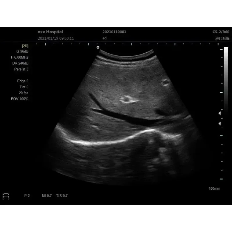 12 Inch Ultrasound Scanner Portable Black White Probe for Horse Cow Dog Portuguese Language XF P20 Veterinary Machine Laptop