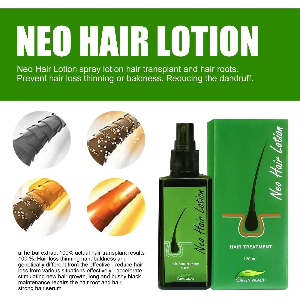 Hair Care Lotion 120 ml Hair Regrowth Treatment Growth Strengthens Damaged Loss Revitalizes Scalp For Men & Women