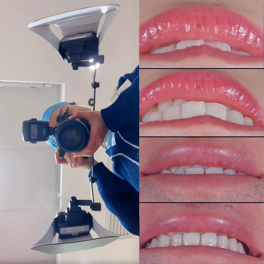 Twin Flash Flash Nikon R1c1 Ring Flash Twin Flash Nikon R1c1 New