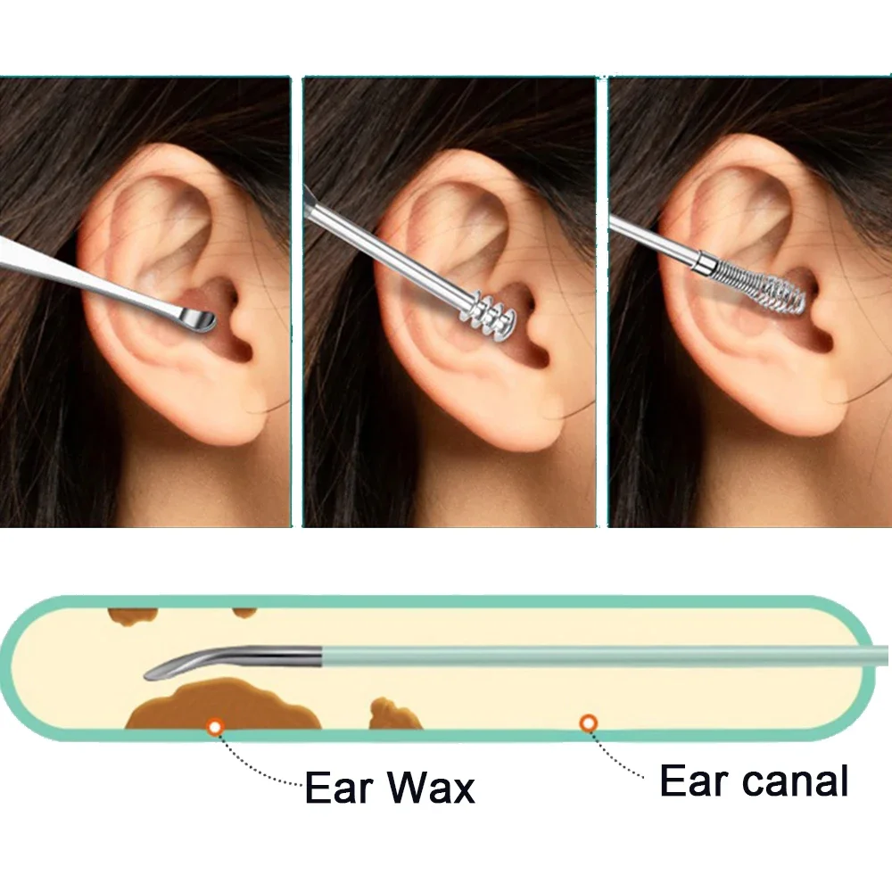 Ear Wax Removal Tool Set - Spiral Ear Cleaner with Rotating Ear-Picking Spoons