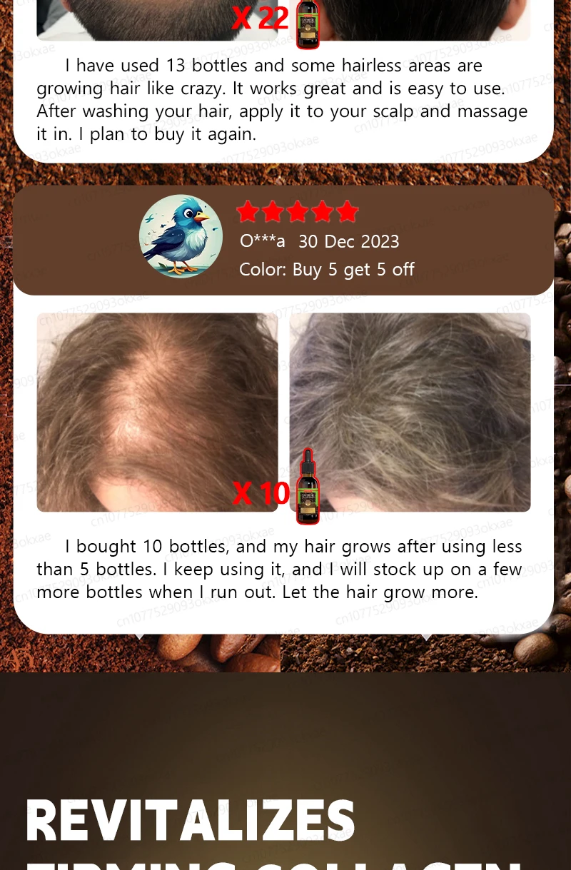 Description Picture 5 of itemUnisex Hair Growth Oil Hair Loss Treatment Rapid Hair Growth Effective Baldness Repair Hereditary Postpartum