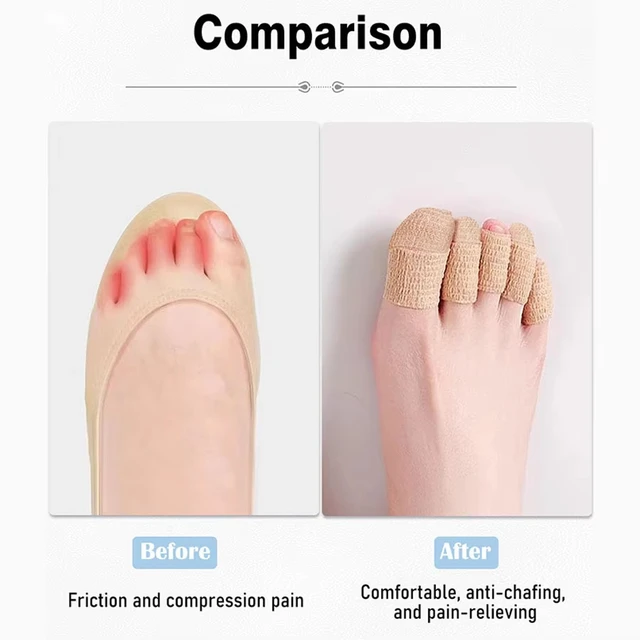 1/5/10 Roll Comfortable Toe Protectors - Anti-Friction Bandages To Protect Toes And Fingers, Prevent Roughness, Unisex 5