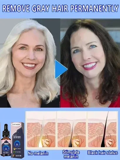 White hair killer, remove gray hair and restore natural color in 7 days