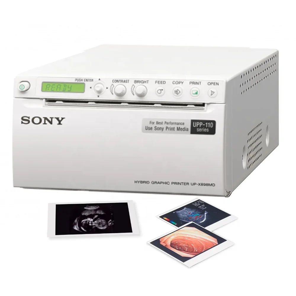 

UP-X898MD Medical 3D 4D Доплер, ультразвуковой видеопринтер, цена, портативный термопринтер для ветеринарного ультразвука