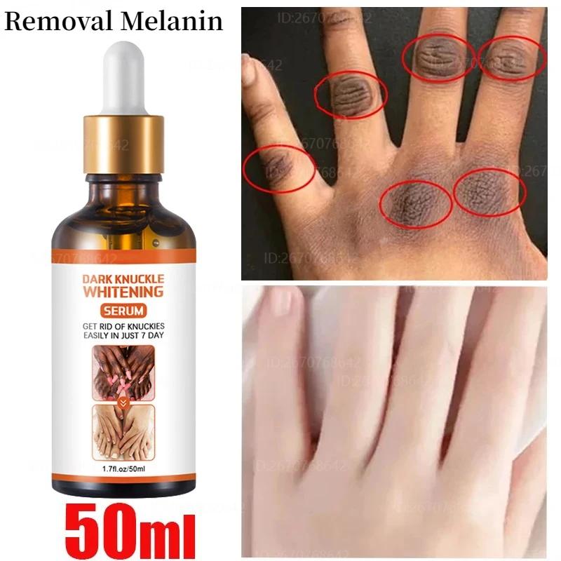 Melanin Removing Essence Dark Knuckles Fast Whitening Serum Hand Knuckle Elbows Knee Stains Remover Products Brightening Care women finger joints whitening serum powerful removal melanin essence elbows knee whiten serum dark skin brightening products