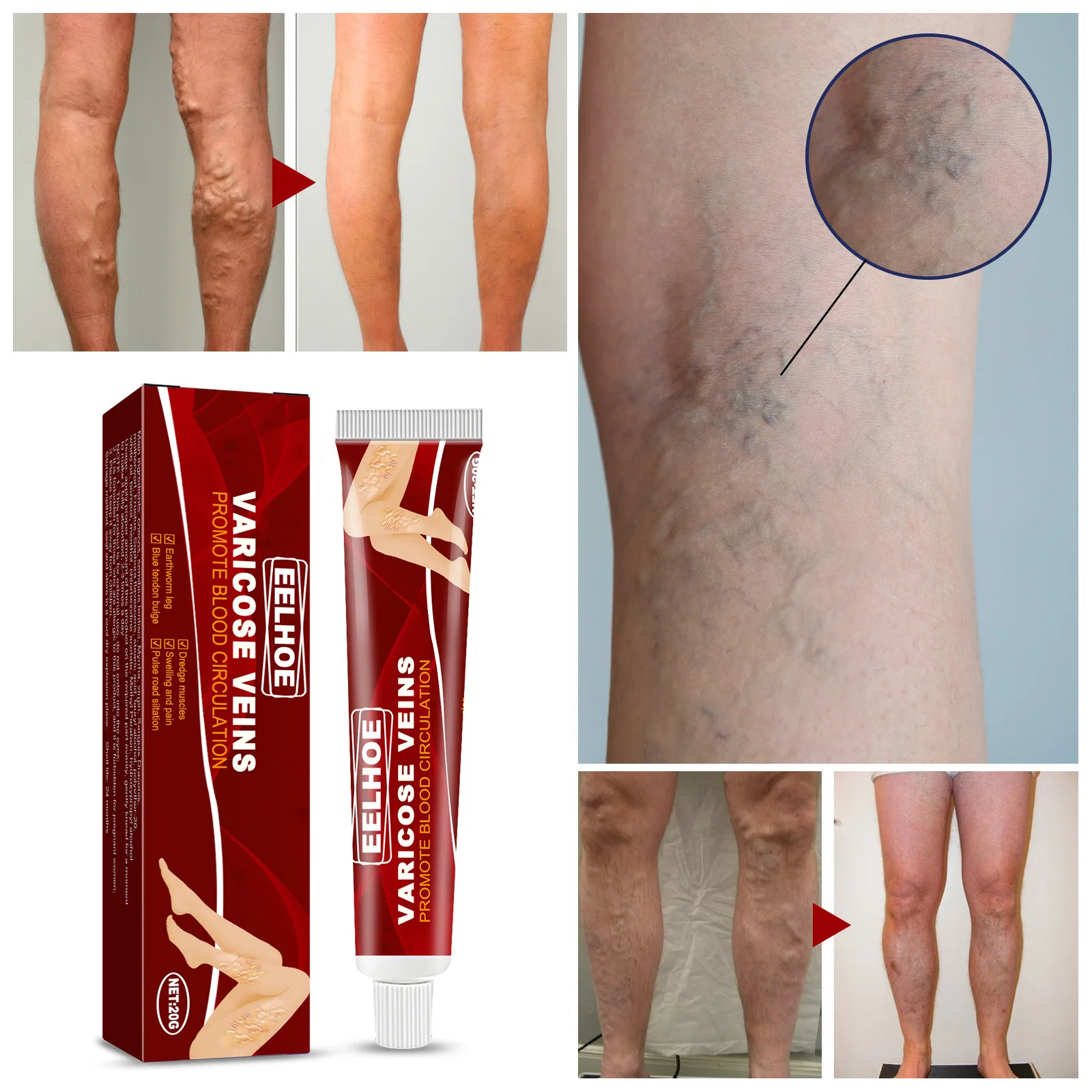 

3Pcs Varicose Veins Treatment Cream Effective Varicose Vein Relief Legs Tired Dilated Vasculitis Phlebitis Spider Pain Legs Care
