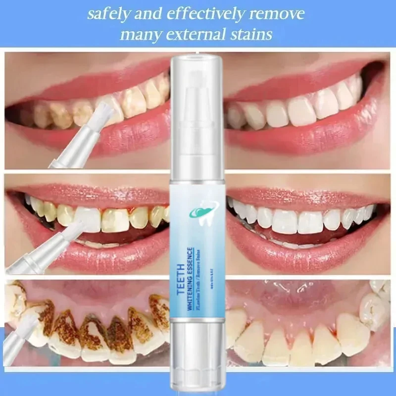 Teeth Whitening Product Teeth Whtening Toothpaste Pen Remove Plaque Stains