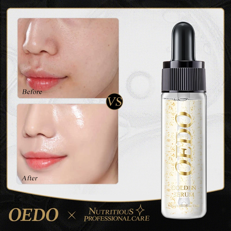 OEDO Gold Serum Anti-Aging Fade Fine Lines Deeply Nourishing Moisturizing hydrating Improve skin tone Facial Treatment Essence 3
