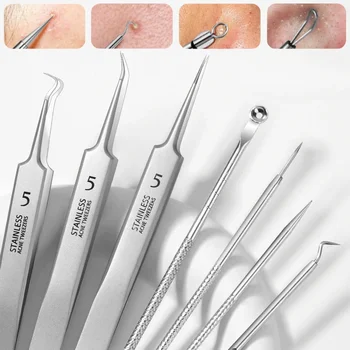 Acne Extractor Kit 1