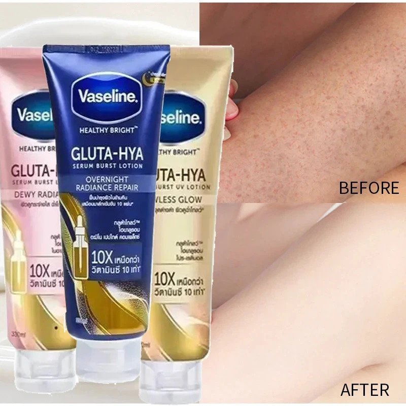Vaseline Whitening Body Lotion Drying Moisturizing Cream Nicotinamide Long Acting Body Lotion Chicken Skin Removing Cream