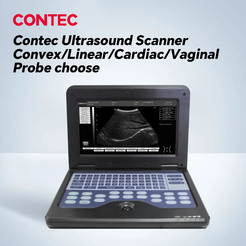 CONTEC Digital Portable Laptop Ultrasound Scanner Machine Convex/linear/cardiac/Transvaginal probe Clinic or Hospital Use