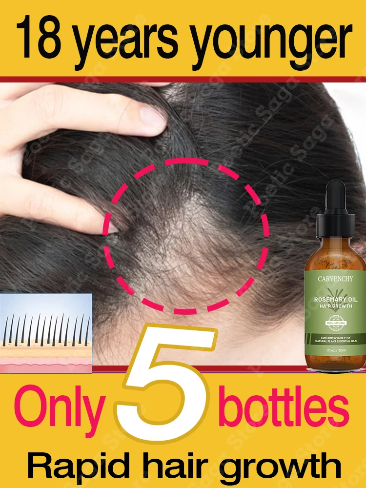 

Hair Growth Products Fast Hair Growth Oil Essence For Men Women Anti Hair Loss Effective Baldness Repair Hereditary Hair Loss
