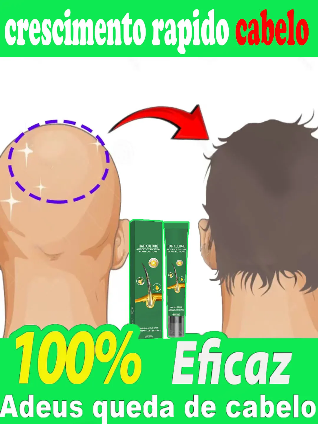 Successful products, 99% of buyers will buy again, they have more and more hair, say alpha baldness, thick hair