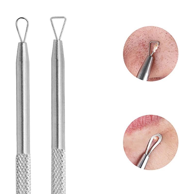 Stainless Steel Acne Needle for Skin Care blackhead remover acne remover
