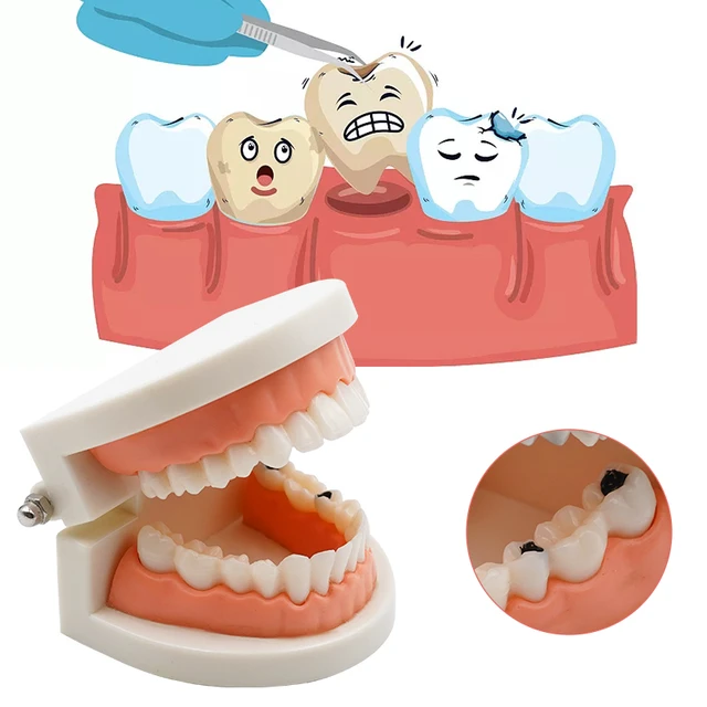 Vente de Modèle de dents d'enfants Modèle d'étude de démonstration en  pathologie pédiatrique 4002 en ligne 