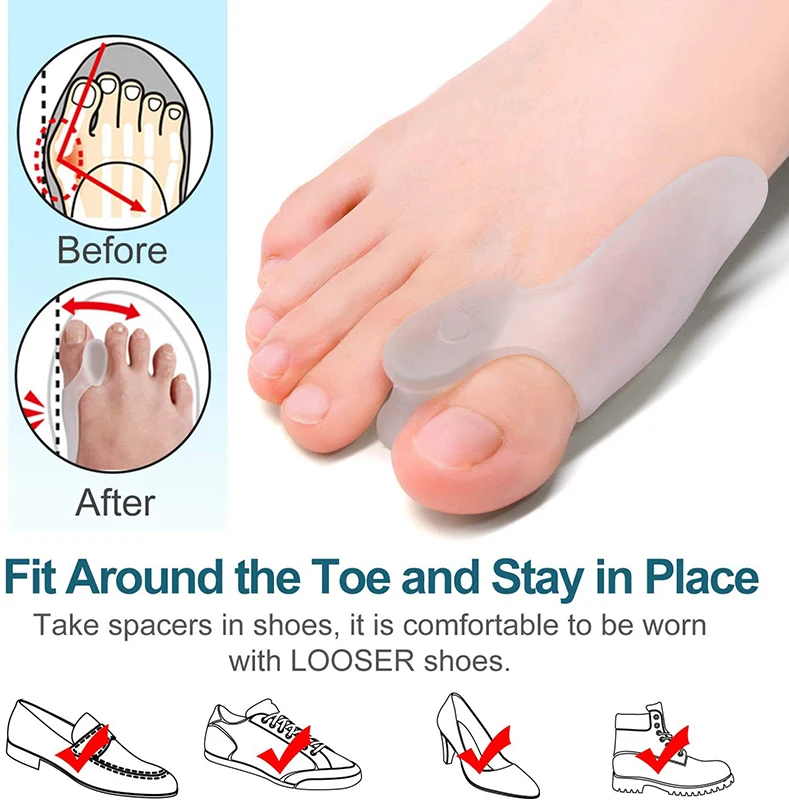 Get Relief from Bunions with 2pcs Soft Big Toe Corrector - Perfect for Night and Home Use, Long-term Comfort 6