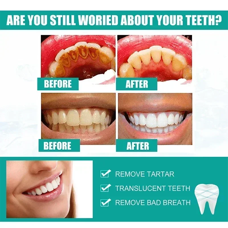 Dissolvant de calcul dentaire, blanchiment des dents, vaporisateur, livres de dentifrice, hygi&egrave;ne buccale, &eacute;limination