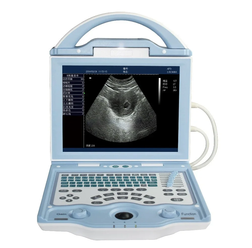 

2016 new launches Price Health Diagnostic Ultrasound machines SUN-800W