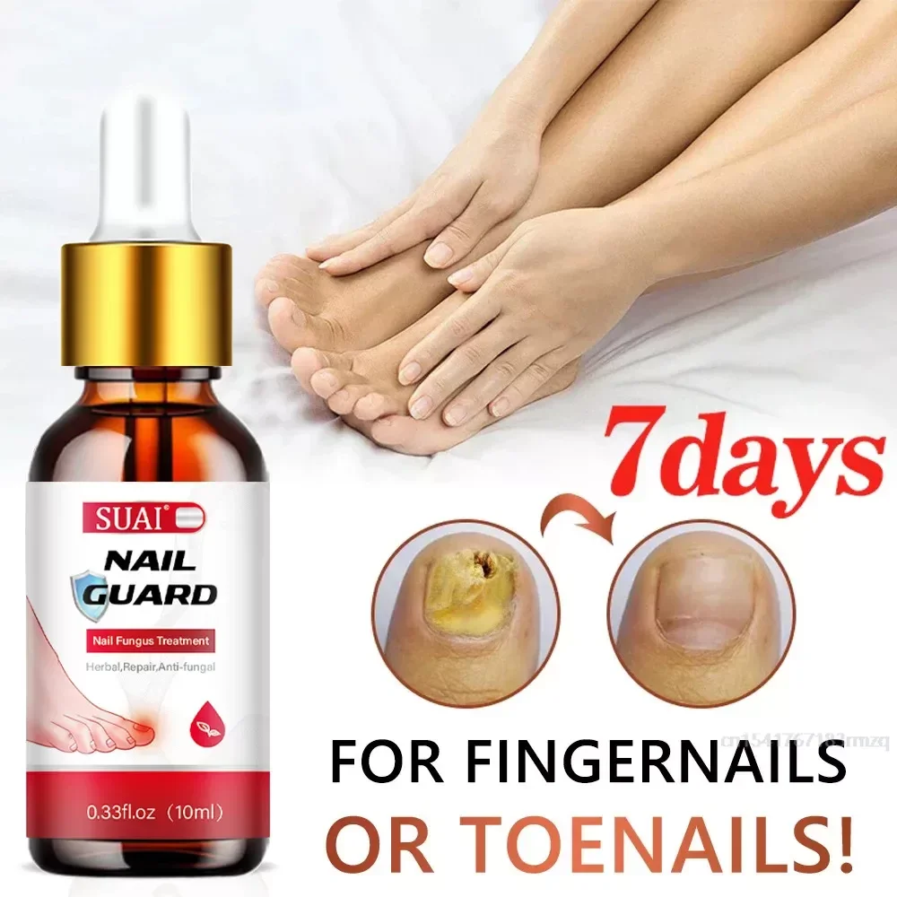 u&ntilde;asFungal Nail Device Repair Fast Nails Fungus Onychomycosis Repair Nails Toenail Fingernail Removes Nail Fungus Foot Treatment nail fungus remover