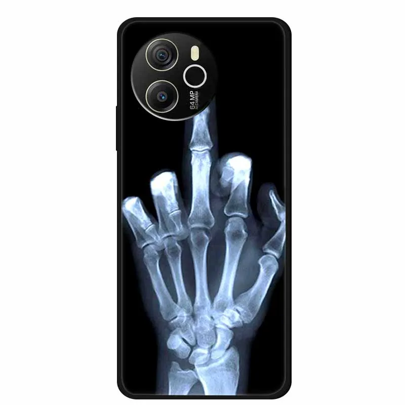 Animal Painted Soft TPU Silicone Back Cover - Fashionable Phone Case