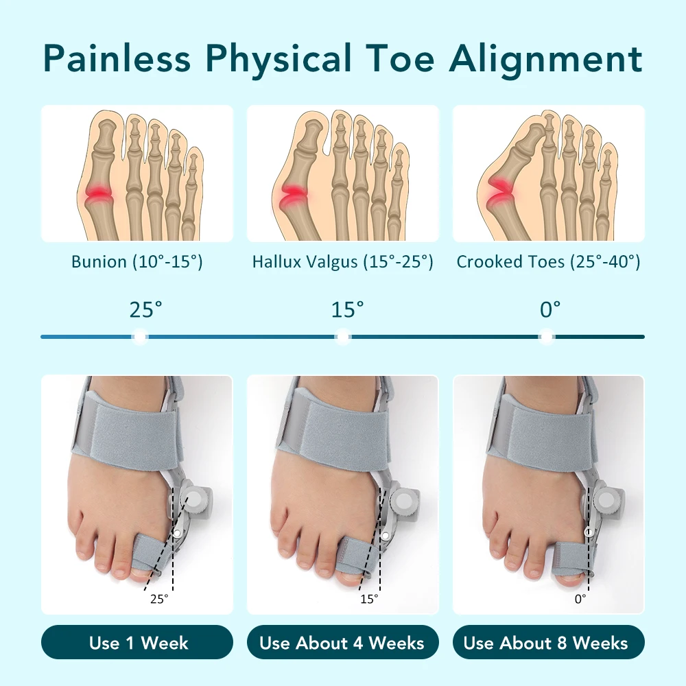 Toe Splint Bunion Corrector Adjustable Big Toe Valgus Correct Tool for Left Right Feet Straightener Orthopedic Foot Thumb