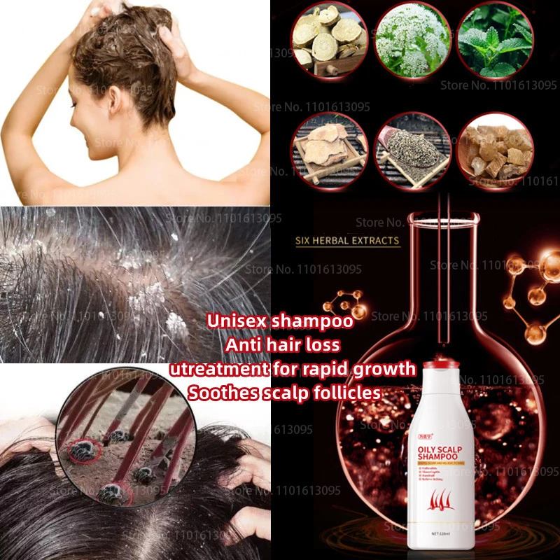 Scalp Folliculitis Natural Treatment