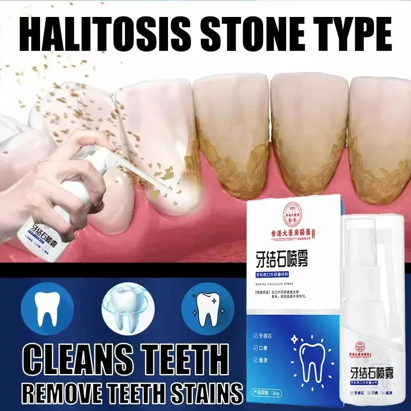 Dental Calculus Remover Teeth Whitening Spray Toothpaste Cleaning Oral Hygiene Removal Halitosis Plaque Stains Fresh Breath Care dental calculus remover