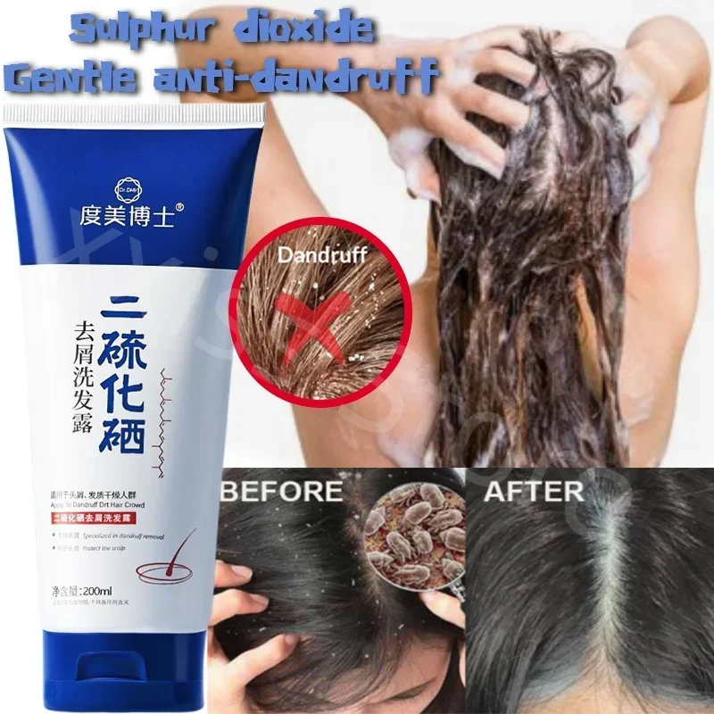 Selenium Sulfide Anti-dandruff and Anti-itch Shampoo MoisturizingScalp Oil Control Cleansing and Mite Removal Refreshing Shampoo