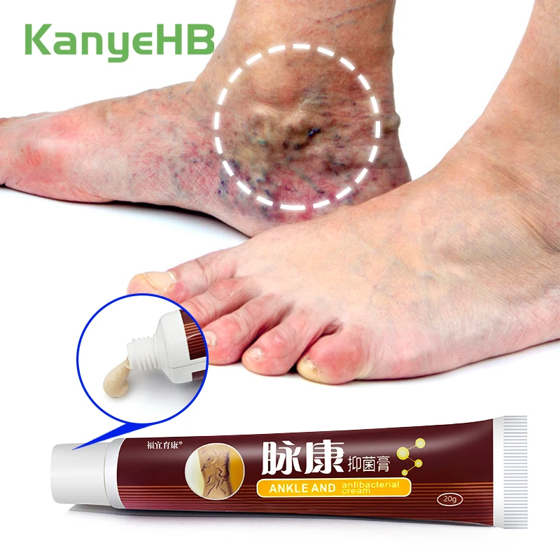 

1pcs Varicose Vein Herbal Cream Veins Swelling Pain Relief Cream Phlebitis Vasculitis Varicosity Ointment Varicocele Cream S034