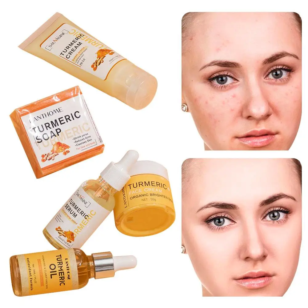 5pcs Turmeric Skin Care Sets Natural Facial Acne Cleansing Cream Fade Dark Spots Turmeric Serum Anti-Aging Skin Moisturizing