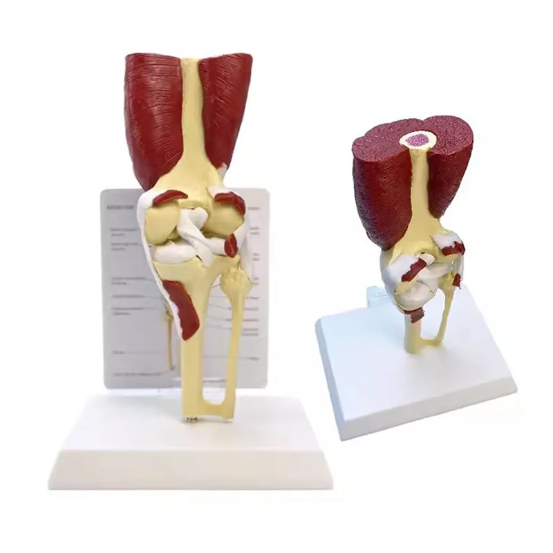 

Life Size Knee Joint Anatomical Model With Muscles Human Anatomy Skeleton Model Medical Student and Patient Education Tool