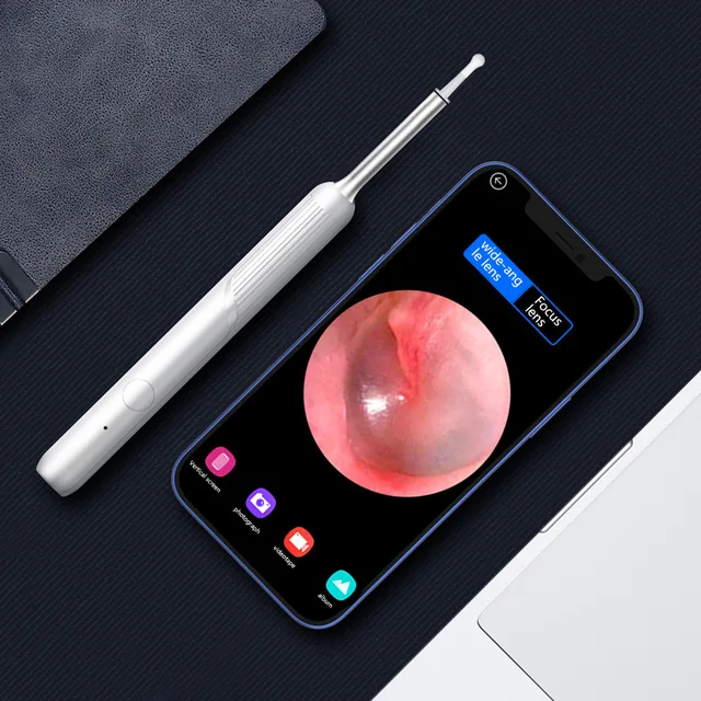 Xiaomi Intelligens Vizuális Fülpálcák Endoszkóp 400W Nagy Pontosságú Füldugó Mini Kamera Otoscope Health Care Fül Tisztító Tiszta Szerszám - Image 2